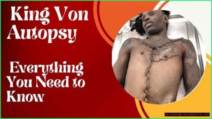 Unraveling The King Von Autopsy Results