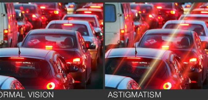 Unveil The Hidden Truths: Uncorrected Astigmatism Lights Decoded