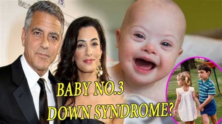 Unveiling The Truth: George Clooney And Down Syndrome